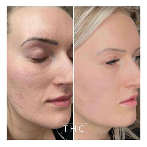 Zo-skin-health