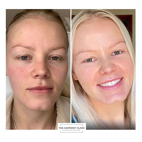 Zo-skin-health-2