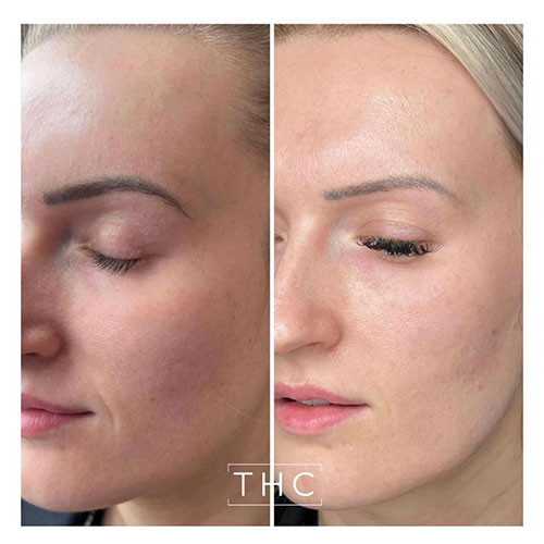Zo-skin-health-3