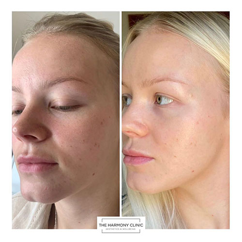 Zo-skin-health-6