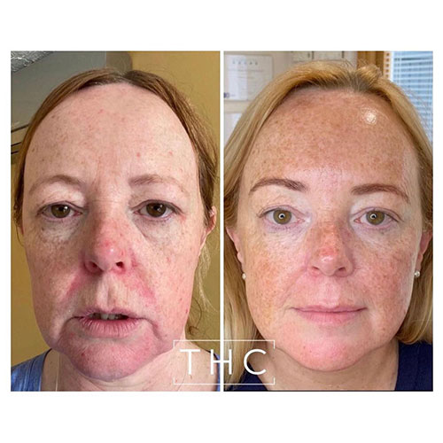 Zo-skin-health-9