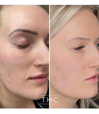 Zo-skin-health