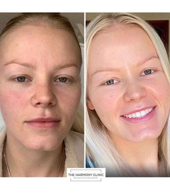 Zo-skin-health-2