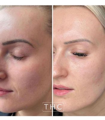 Zo-skin-health-3