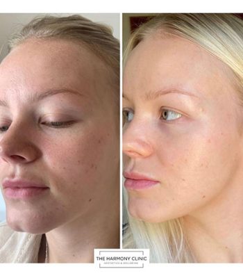 Zo-skin-health-6