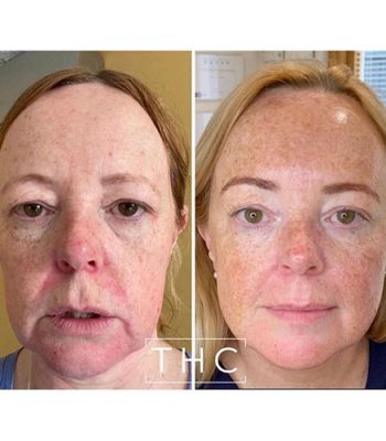 Zo-skin-health-9